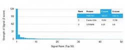 TMEPAI, Mouse anti-Human, Clone: PMEPA1/2698, Novus Biologicals:Antibodies:Primary